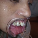 dental clinic kollam