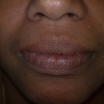 dental clinic kollam