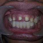 dental clinic kollam