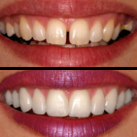 aadic kollam dental clinic - Smile Designing